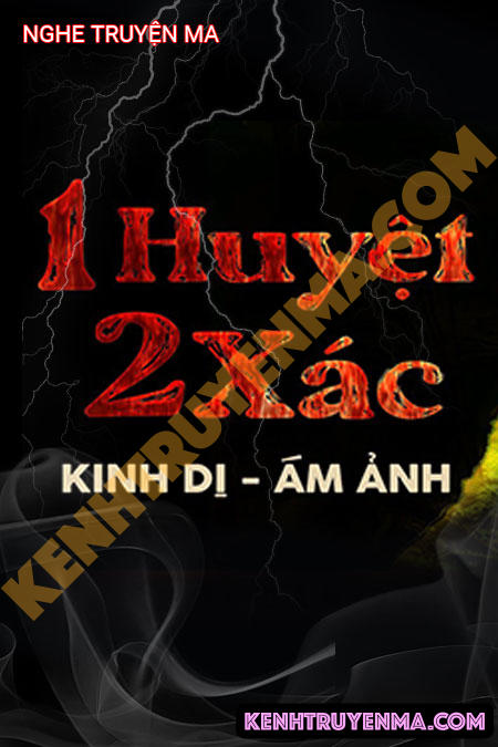 1 Huyệt 2 X.ác